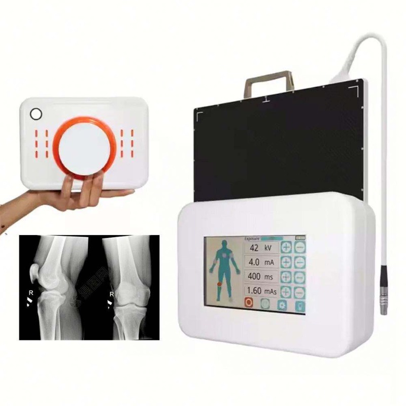 Veterinary X-Ray - جهاز أشعة سينية رقمي محمول صغير